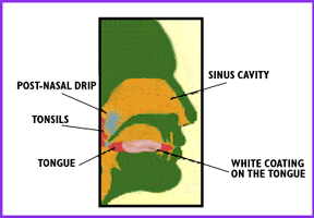 sinus cavity